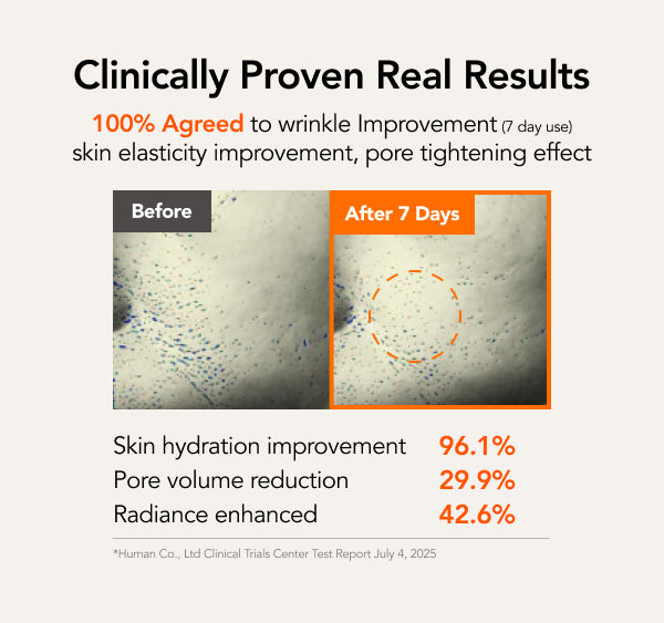 LIFT_MO_2-1.jpg__PID:5c32a80b-4acc-4032-8b44-8dfd11ee5f90