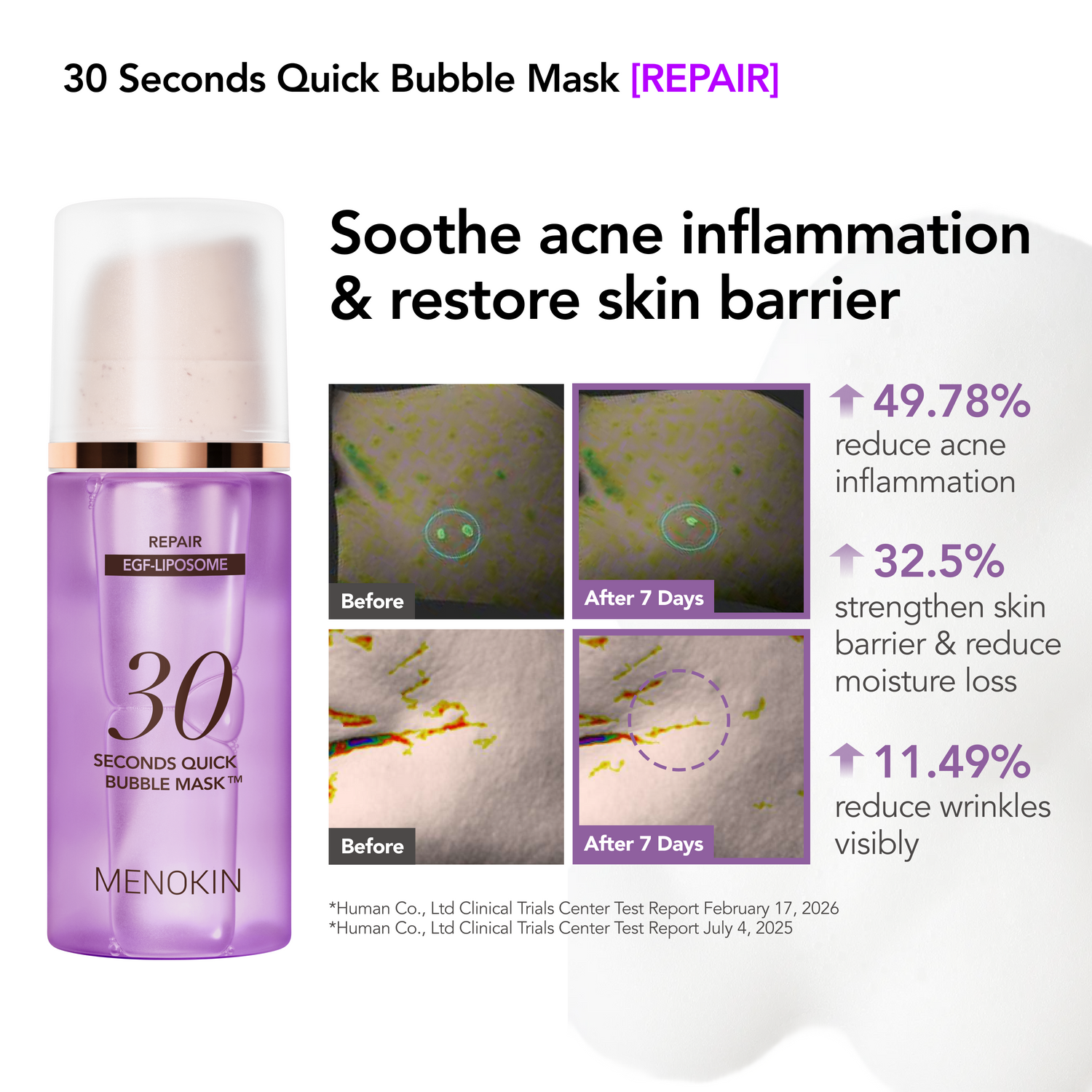 [Best-Seller] Bubble Essentials Set