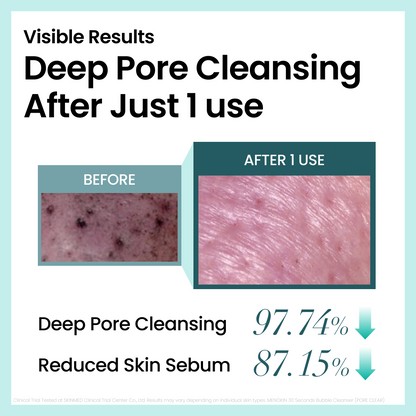 Bubble Cleanser Full Set