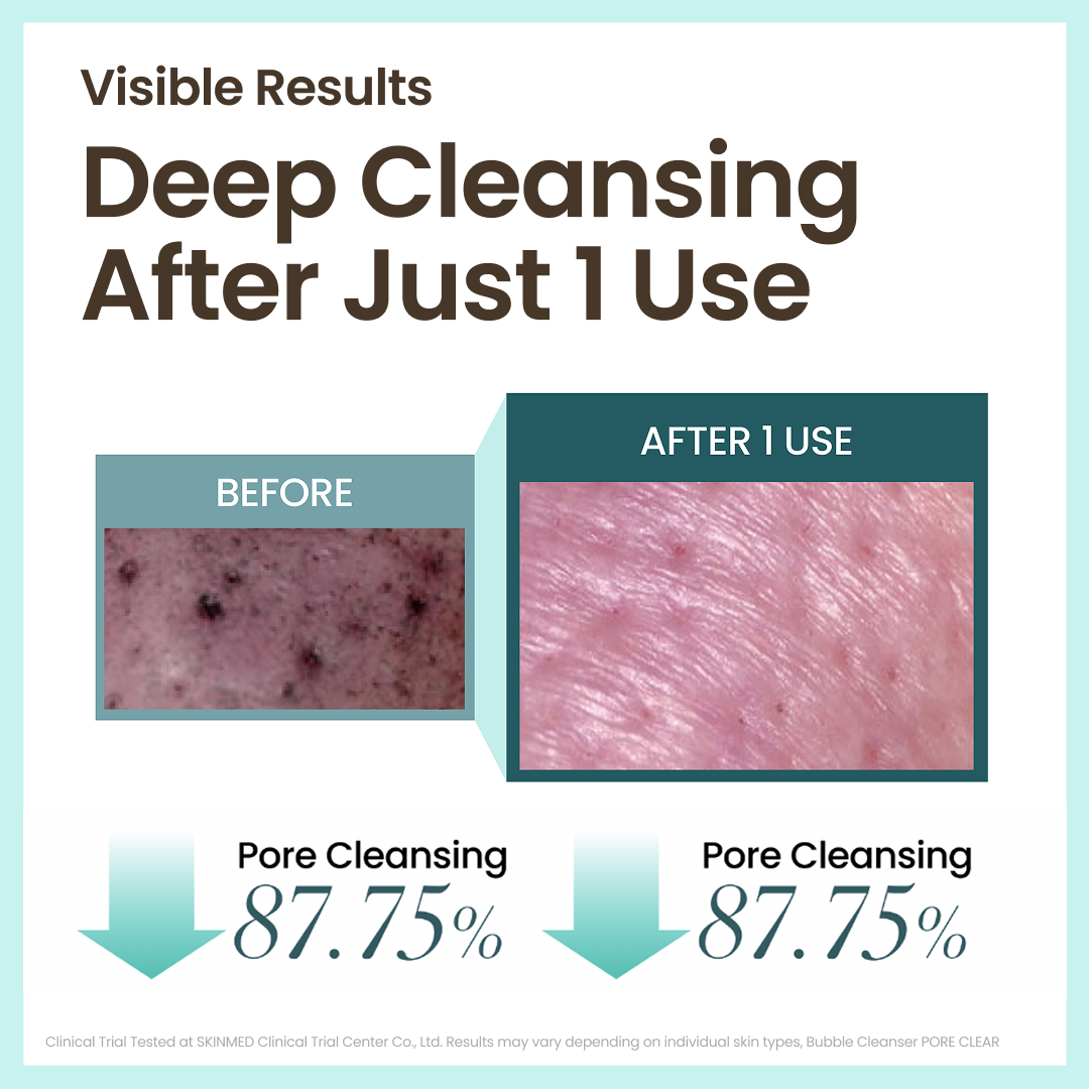 [Secret Amazon Deal] 30 Seconds Micro Bubble Cleanser Never Strip