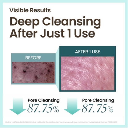 [Secret Amazon Deal] 30 Seconds Micro Bubble Cleanser Never Strip