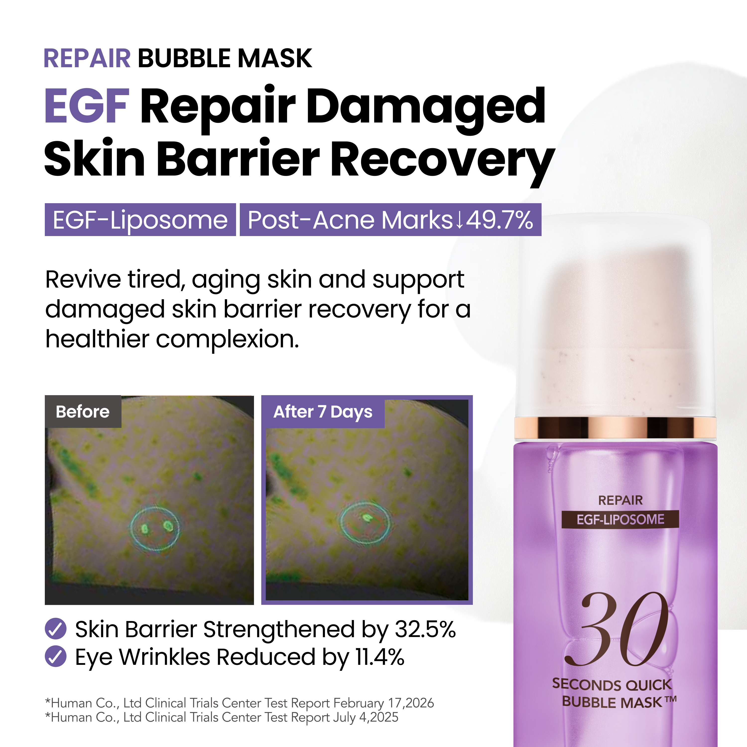 Bubble Mask Full Set